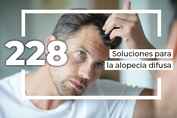 soluciones alopecia difusa